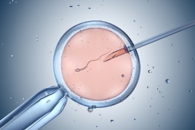ICSI fertilization procedure in a fertility laboratory